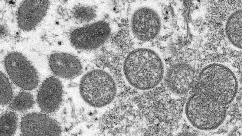 猴痘病毒對哪類人風險更大？美CDC發警告