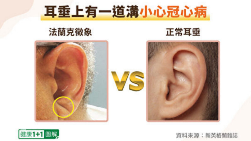 耳朵1徵兆恐是冠心病！按按耳朵防心臟病、高血壓