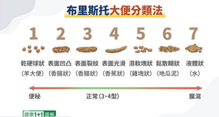 不能每天排便不用擔心 吃對一類營養擊退便祕