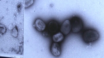 洛縣疑現首個猴痘病例 等待CDC確認