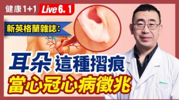 【健康1+1】耳朵这种折痕 当心冠心病征兆