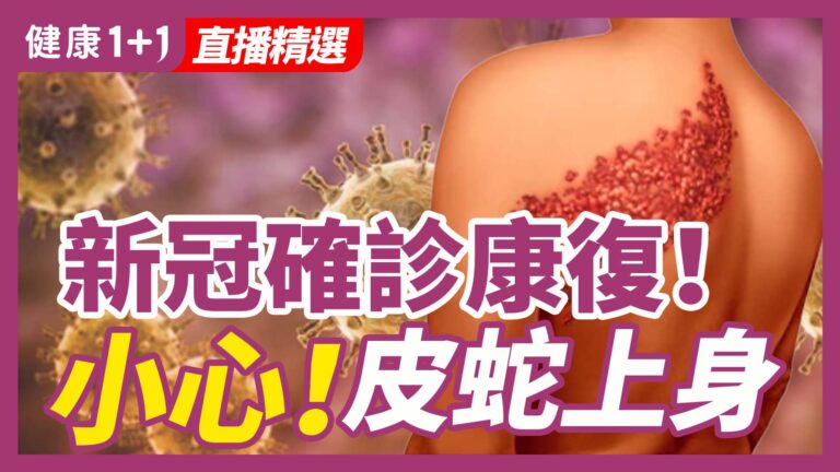 【健康1+1精選】新冠確診康復！小心！皮蛇上身