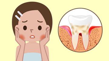 牙周病会自己好？6症状要小心 3食物可能是元凶