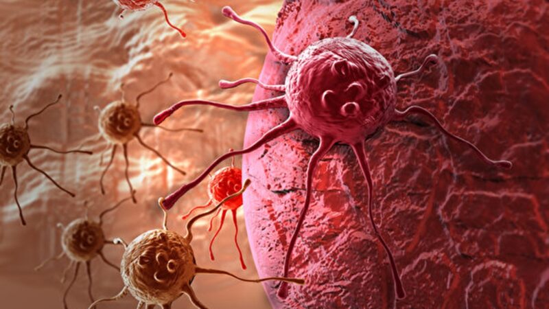 半數的癌症可以預防 遠離7種致癌物降低罹癌風險