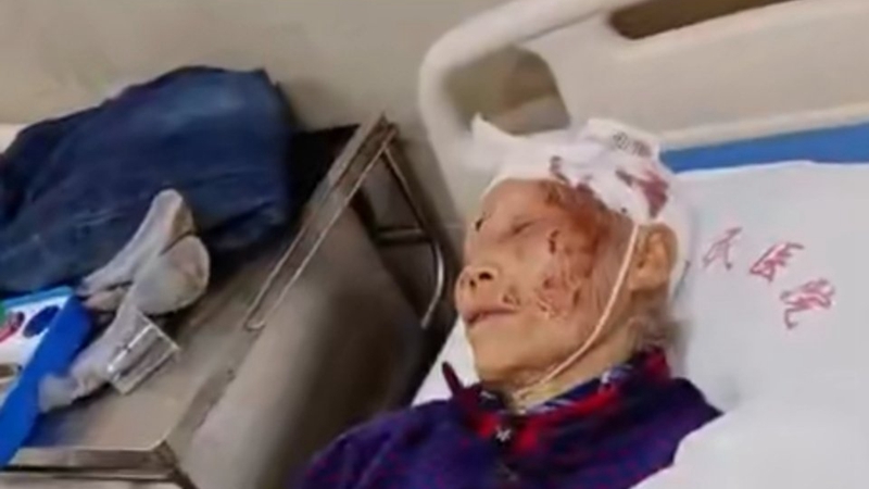 除夕夜 湖南83岁老母亲遭儿媳棍打 头破血流（视频）