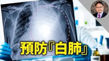 【四維健康】如何避免出現「白肺」？白肺是新冠肺炎特有的嗎？