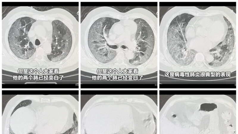 中國出現「白肺」現象 美專家：這說不通