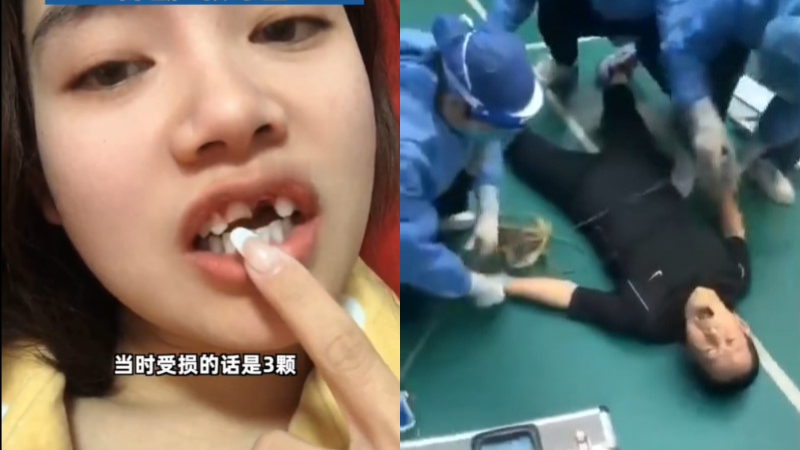 陽康後運動事故多 山東女健身暈倒摔斷3顆牙