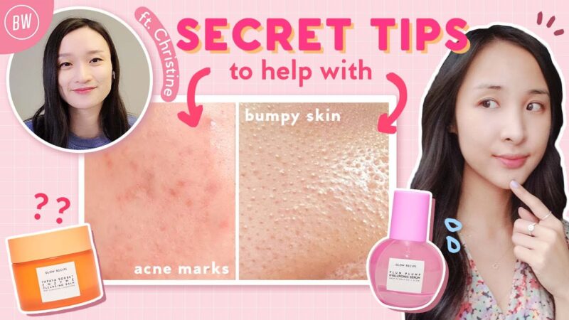 【Beauty Within】如何改善护肤流程以减少痤疮色斑和皮肤细纹