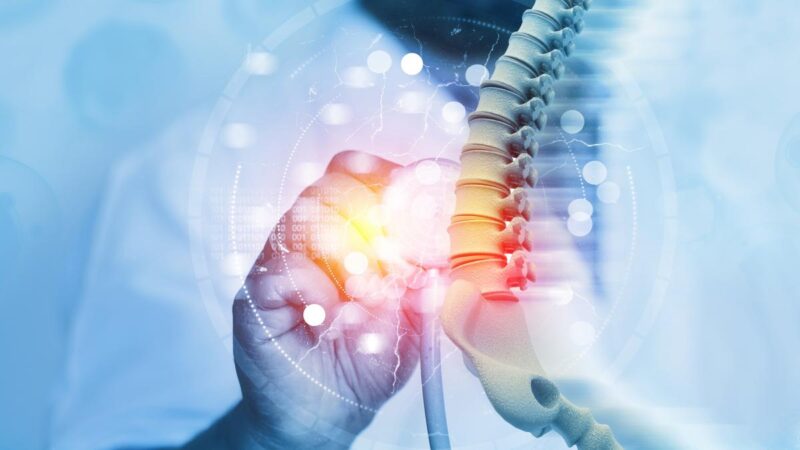 研究：電刺激脊髓可助中風患者恢復手臂功能