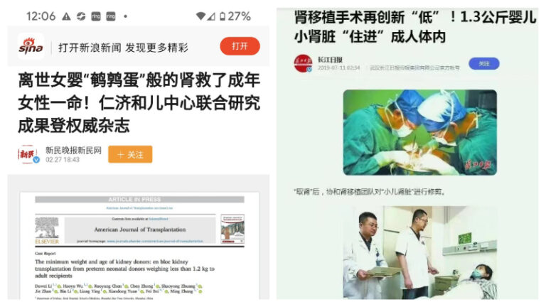 割未足月嬰腎臟移植給成人 黨媒吹噓恐怖「技術」