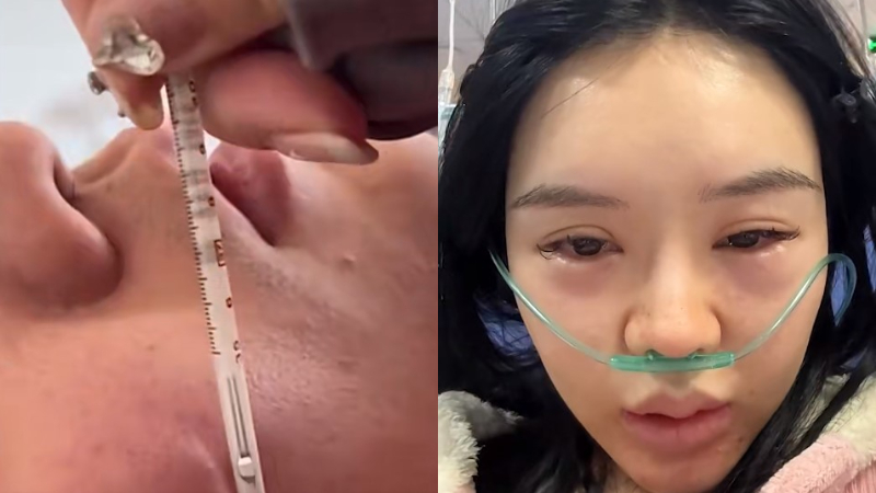 男子高燒體溫計貼臉狂飆 女子燒三天用上呼吸機（視頻）
