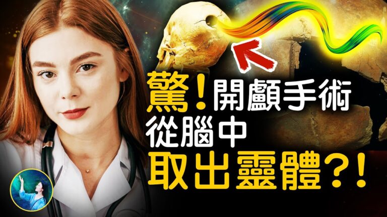 【未解之謎】古代開顱手術