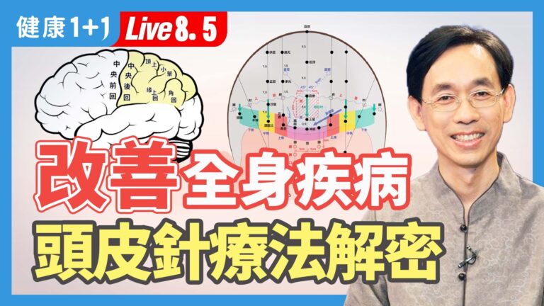 【健康1+1】改善全身疾病 頭皮針療法解密