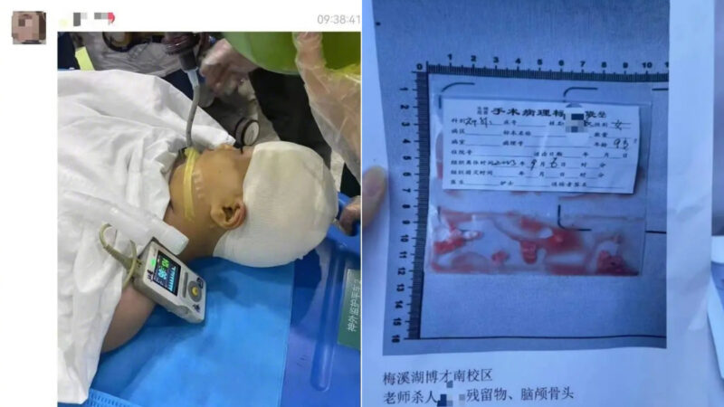 湖南教師打傷9歲女生致開顱手術 點燃民眾怒火