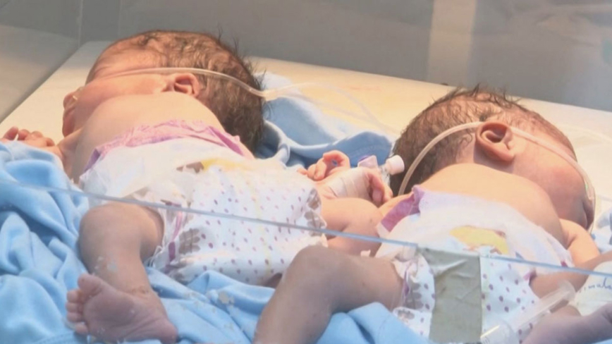 奇迹 乌干达70岁妇女产下双胞胎