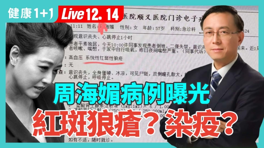 【健康1+1】周海媚病例曝光 红斑狼疮？染疫？