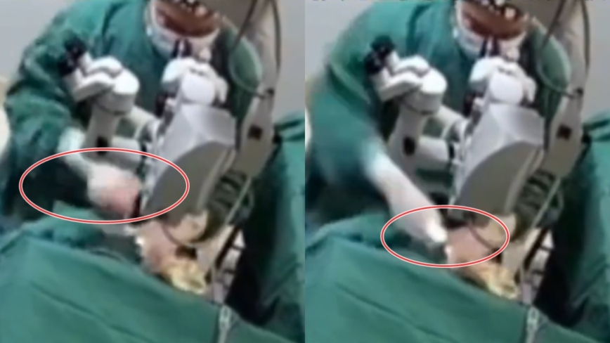 广西医生手术恐怖 猛捶82岁患者致失明（视频）