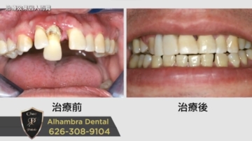 【广告】Alhambra Dental