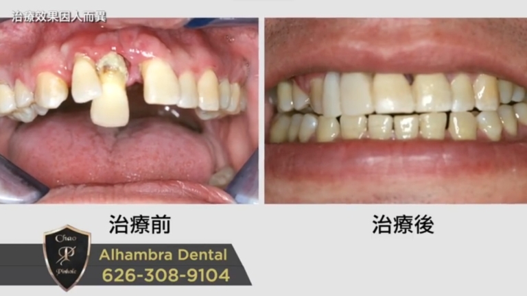 【廣告】Alhambra Dental