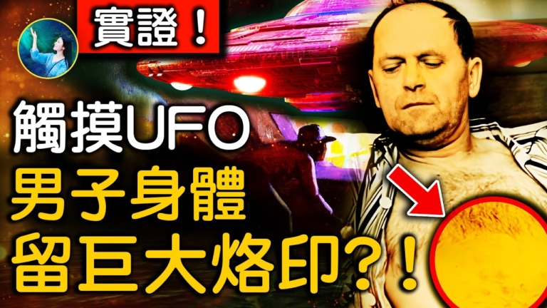 【未解之謎】觸摸UFO 男子身體留巨大烙印 奇異怪味困擾科學家多年