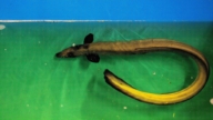越南男子腹痛入院 竟取出30厘米长活鳗鱼