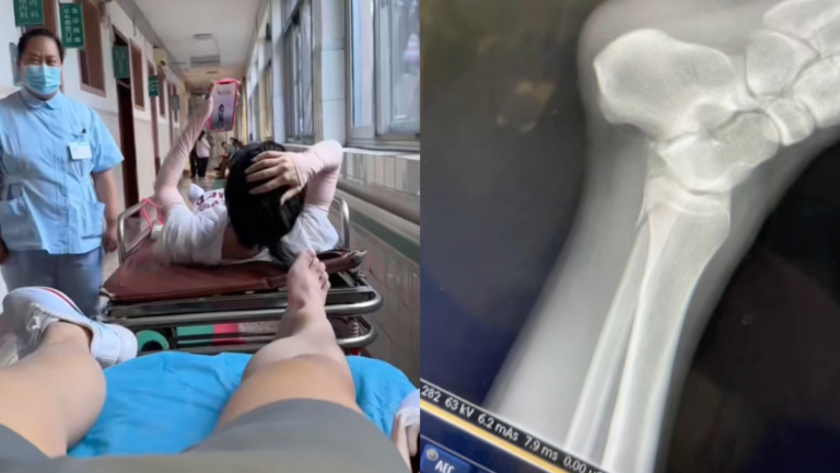 山東《快樂向前衝》綜藝節目 多名參賽者摔骨折
