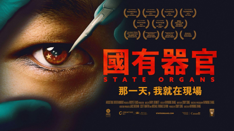 日本中部上映《國有器官》 獲主流人士聲援