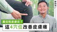 【她健康】異位性皮膚炎？難纏？「這樣睡」竟能輕鬆破解