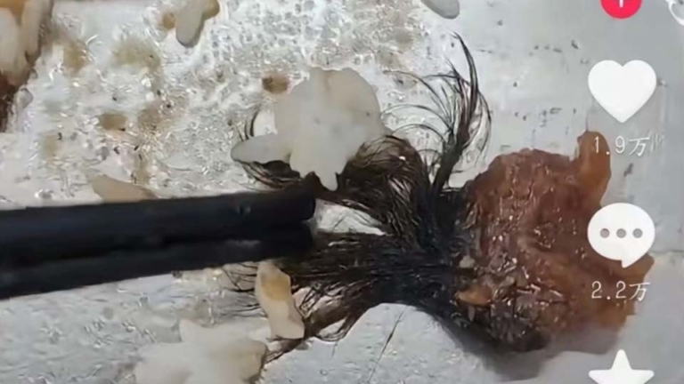山東威海食堂吃出恐怖肉皮 疑似長著人髮（視頻）