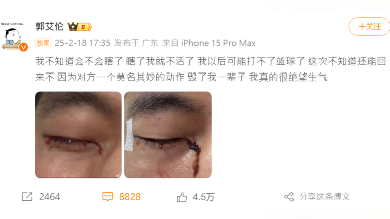 中國男籃隊員郭艾倫被戳傷眼內縫40針 絕望發聲