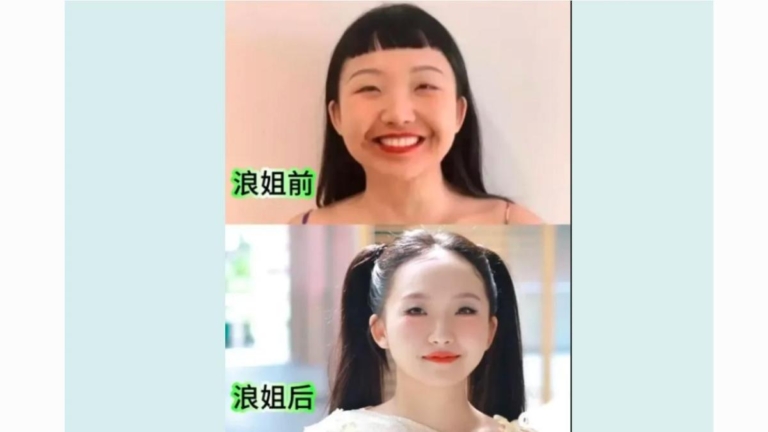 辣目洋子暴瘦10公斤 與3年前圓潤對比照登熱搜