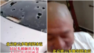 最高13級大風襲北京 多地冰雹 民眾頭被砸出大包