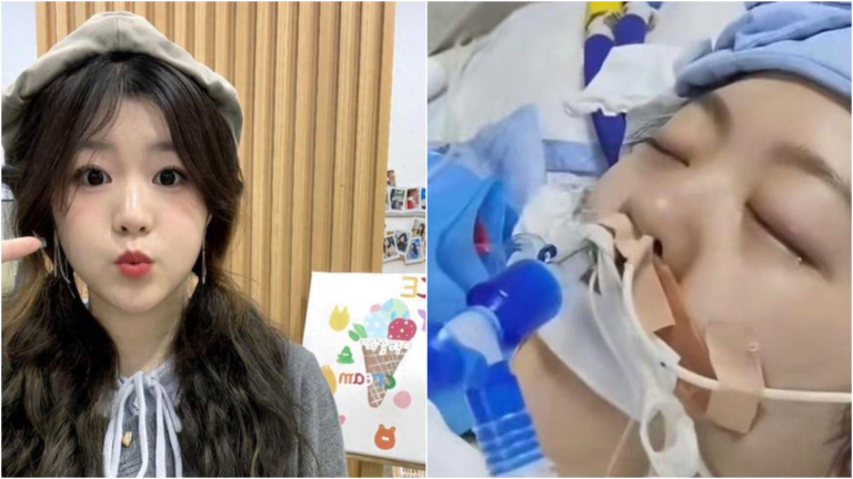 廣東22歲女子做微創手術後腦死亡 網友：匹配成功？