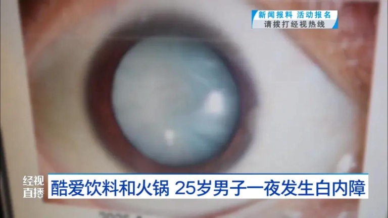 武漢25歲小伙一夜失明 瞳孔全白 因為一飲食習慣