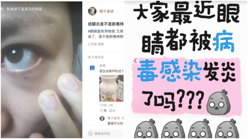 眼睛红肿 有传染性 大陆出现疑似新病毒