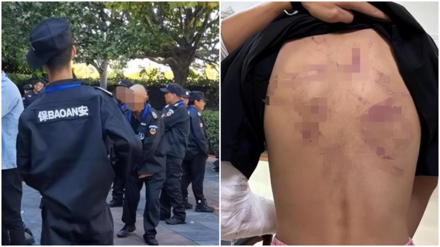 缩略图