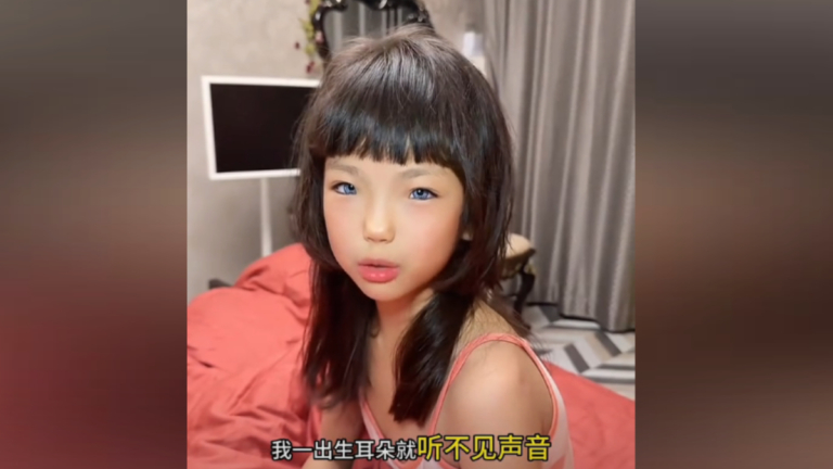 中國8歲女孩患怪病 出生不久眼睛變藍色（視頻）