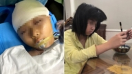 申請再審！被老師打碎頭骨女孩母親披露更多細節
