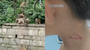7岁男孩对小猴竖中指 遭猴群围殴