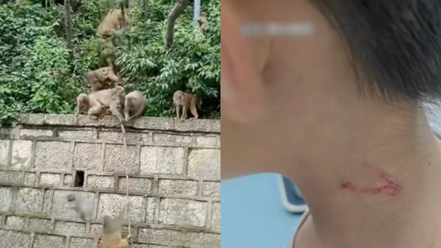 7岁男孩对小猴竖中指 遭猴群围殴