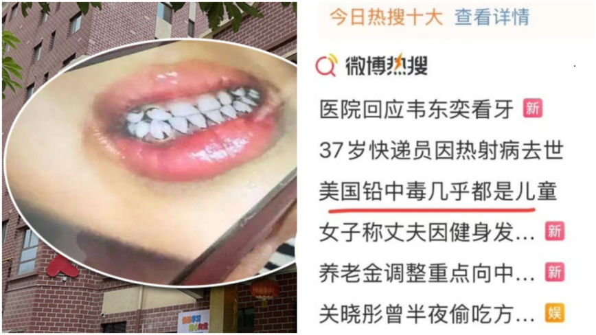 甘肃铅中毒消息被封口 美国铅超标旧闻却登热搜