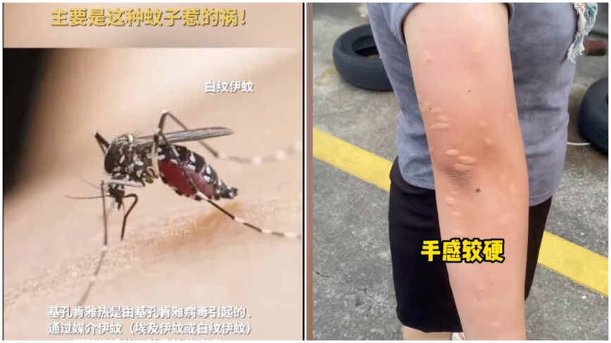 广东佛山发现478例基孔肯雅热病例 引发担忧