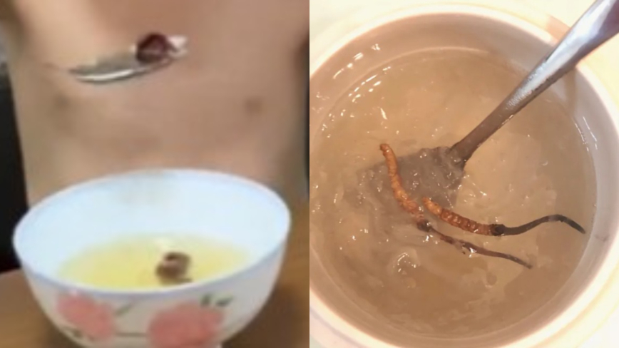 河南童被硬喂燕窝虫草 2年瘦成皮包骨