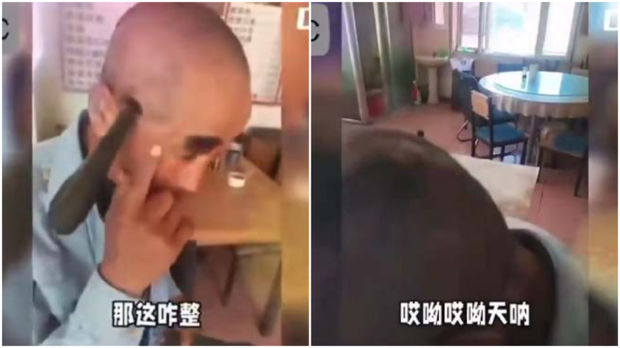 奇迹！东北老农铁棍穿脑 插在头上3年半（视频）