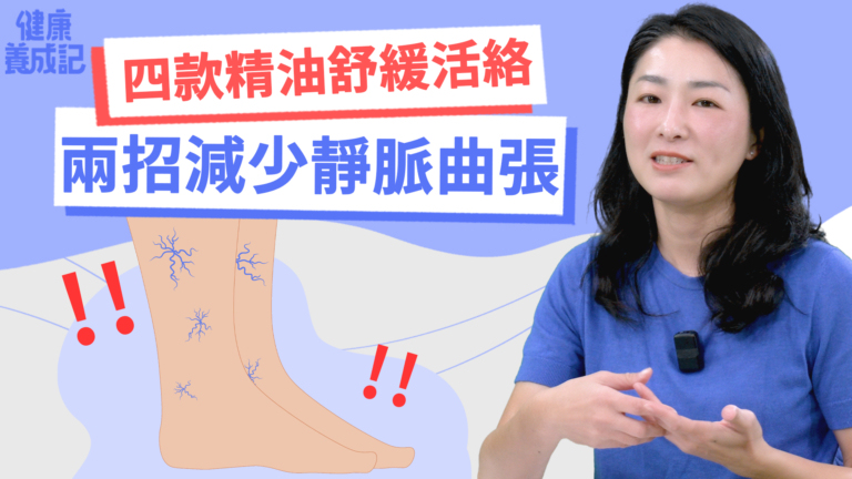 【健康養成記】四款精油鎮定消炎 兩招減少靜脈曲張