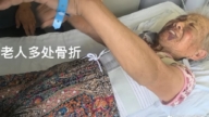 山西运城一老人在养老院遭殴打 多处骨折