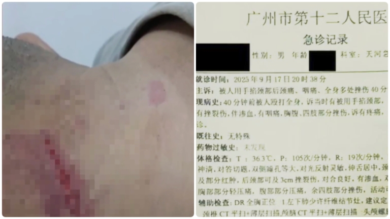牛騰宇父親上告巡視組 被暴打送醫