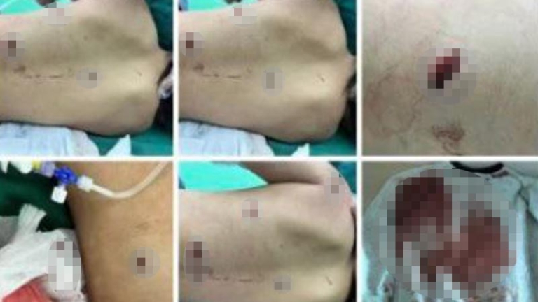 河北9歲男童連捅女同桌6刀 受害者家屬被封口