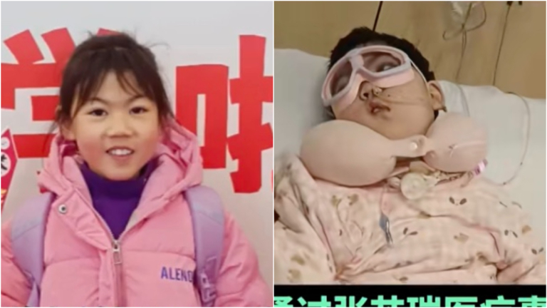 9歲女童手術後成植物人 河南醫院篡改病歷